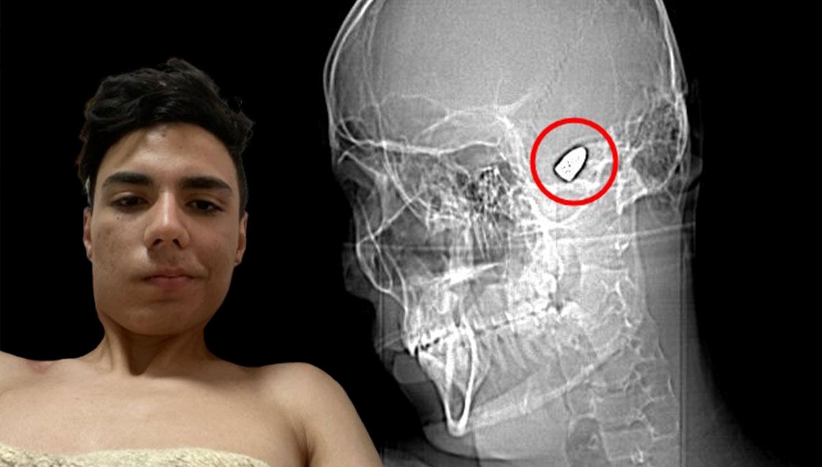 Kafasının içinde patlamaya hazır bomba ile dolaşıyor