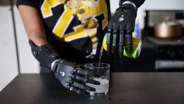 Mucize biyonik el: Koldan ayrıldığında bile hareket ediyor